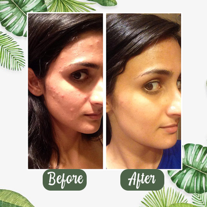 Lecherous™ Green Tea Cleansing Mask Stick 🌿