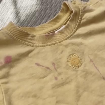 StainZap™ Ultimate Stain Remover Spray 🧼✨